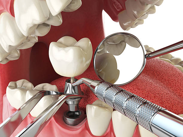 Best Emergency Gum Treatment in Merion Station, PA